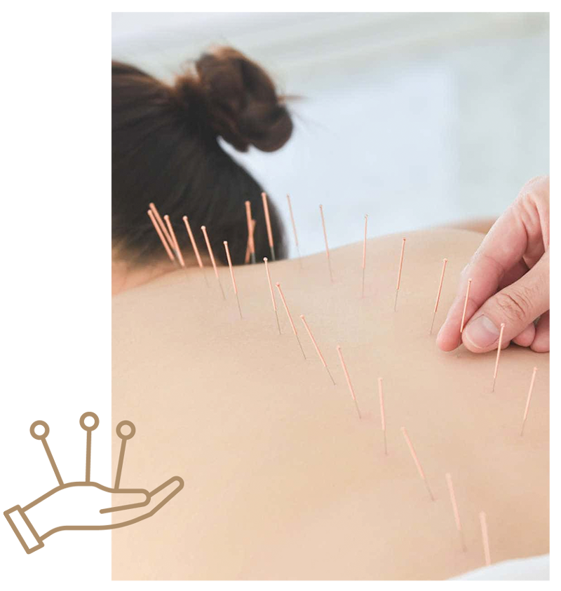 Somatic Rebalancing Acupuncture is a type of acupuncture that focuses on the body's meridians and energy centers. It is used to treat a variety of conditions, including pain, stress, and anxiety.
